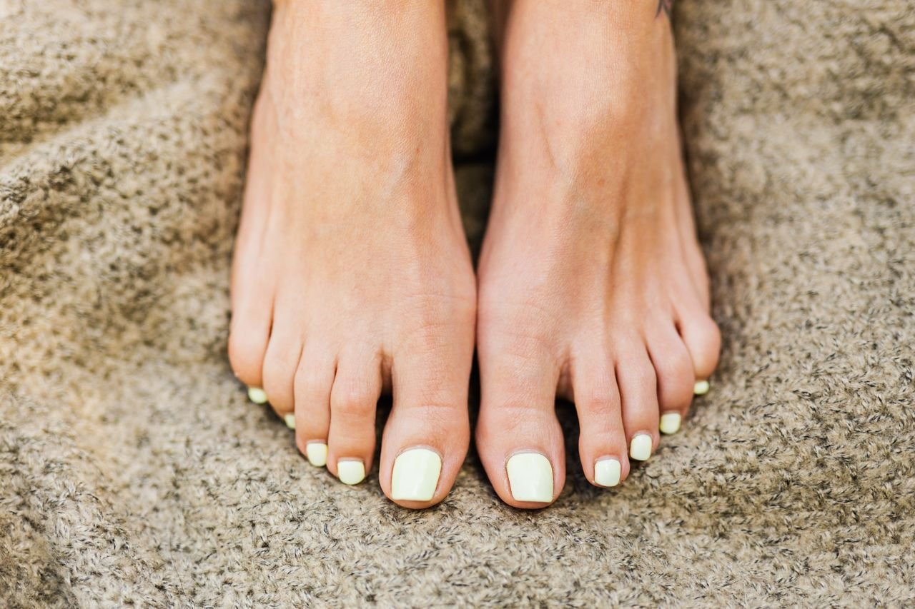 Toenail Fungus vs. Nail Damage: How to Tell the Difference